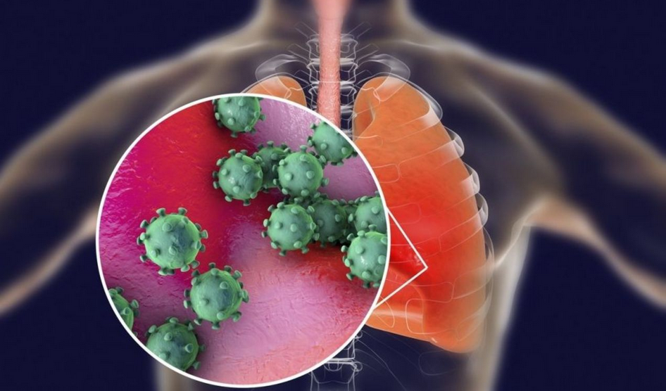 Как отличить коронавирус от ОРВИ, грипп и других заболеваний